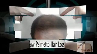 Saw Palmetto Hair Loss Natural Remedy Solutions