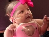 Baby born with heart outside body leaves hospital