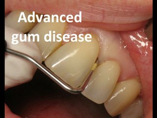 Los Angeles Downey Cosmetic Dentist 562 869 0928