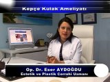 Kepçe Kulak Ameliyatı Op.Dr.Eser Aydoğdu