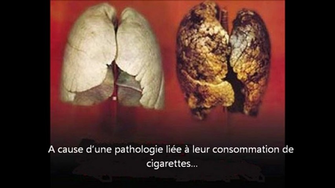 cigarette et dangers pour la santé