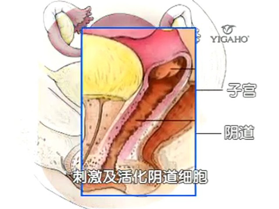 Ladypo将幸福回归原点，把自由还给天下的女性，使女性们从此摆脱烦恼的枷锁，活得更健康，更美，更有自信，享受更美满夫妻生活，也同时获得“性福”与“幸福” 有意者请 联系H/P 012 -4276035 ms khor 012- 4951698