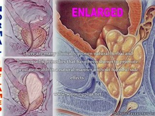 How To Reduce Prostate Enlargement Naturally?