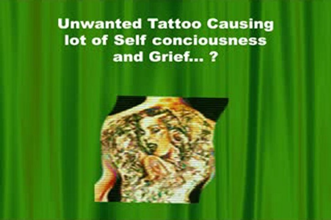 Natural Tattoo Removal - Easiest and Inexpensive way to remove Tattoo
