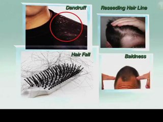 Jawed Habib Total hair therapy Product