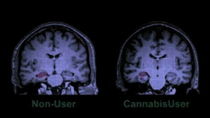 Expert Seed Bank: Discover the Health Effects of Cannabis Strains 🌱