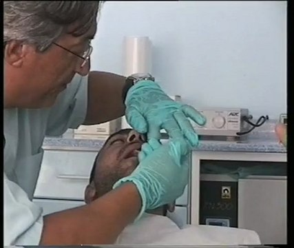 Hipnozla Diş Tedavisi