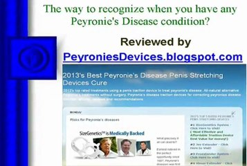 How to identify if you have a Peyronie’s disease?