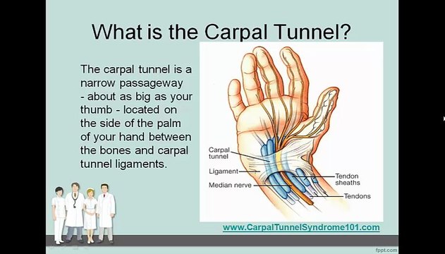 Conquering Carpal Tunnel Syndrome - What is Carpal Tunnel Syndrome?