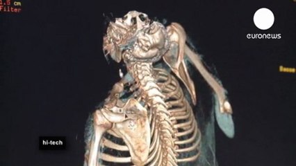 Neuroimagen forense: La autopsia virtual