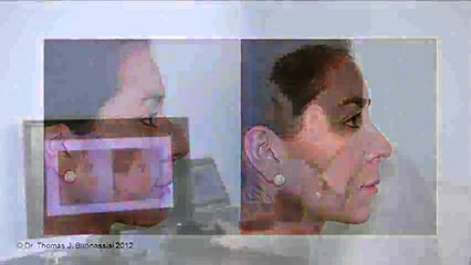 Computer Imaging Case Study