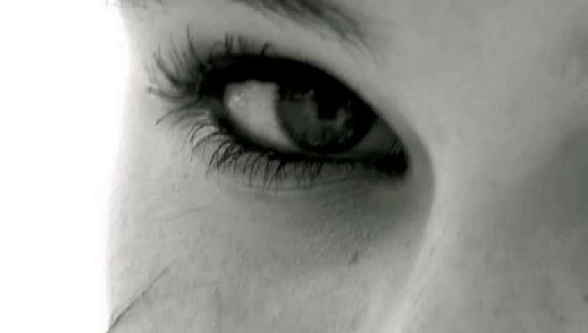 Undifferentiated Schizophrenia Symptoms