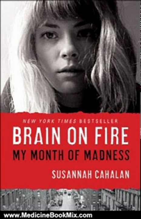 Medicine Book Review: Brain on Fire by Susannah Cahalan