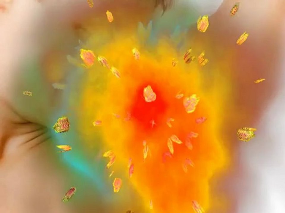 Solutions for Excessive Underarm Sweating