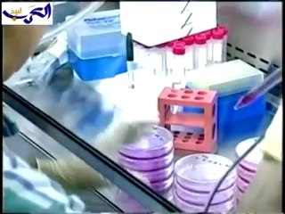 جامعة سكربس تعلن عن تقدم علمي في مكافحة فيروس الإيدز