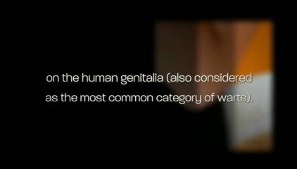 Wartrol - The Ideal Solution For Your Wart Problems