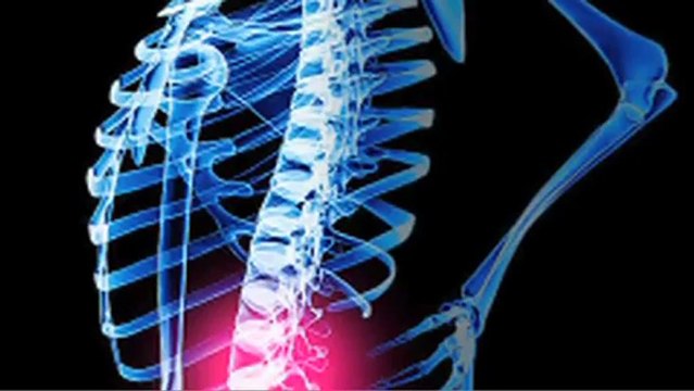 Spinal Cord Injury Attorney Central Florida – Lakeland, Winter Haven