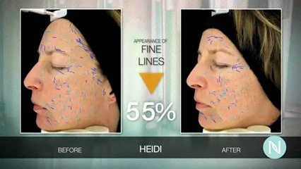 Nerium Skin Care Product Reviews