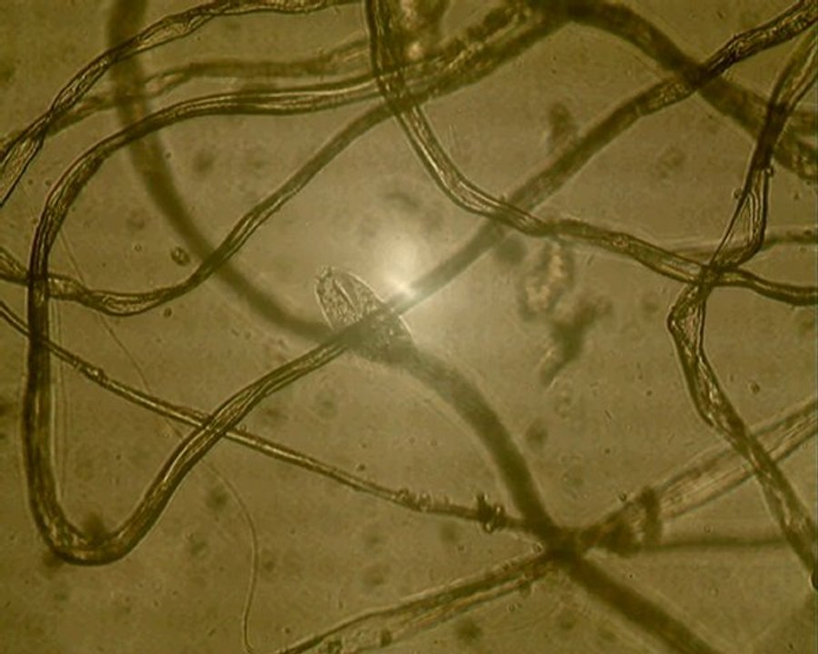 Oxytricha, unicellulaire cilié