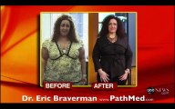 Extreme Weight Loss for Women