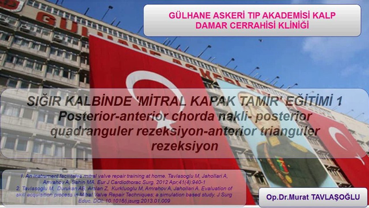 Posterior-anterior chorda nakli- posterior quadranguler rezeksiyon-anteriortrianguler rezeksiyon