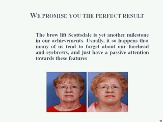 The facelift Scottsdale- a perfect blend of experience, knowledge and surgical expertise