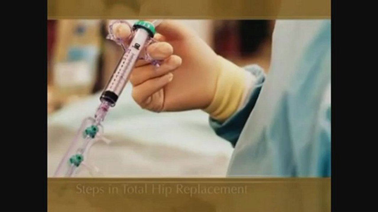 Orthopedic Health - What is Total Hip Replacement?