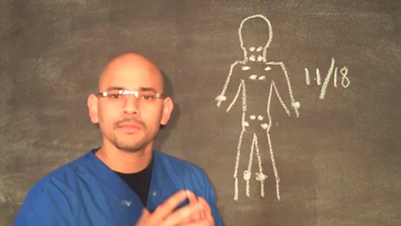 Atlanta Fibromyalgia Treatment Center - Fibromyalgia Trigger Points Diagnosis