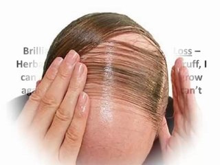 Natural Treatment Review:Herbs For Hair Loss