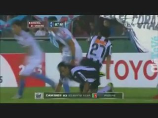 Braghieri à deux doigts de casser le tibia de Ronaldinho !