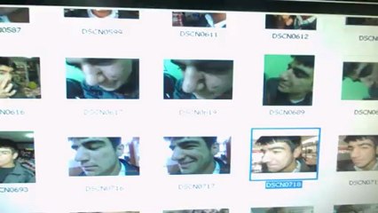 SİVİLCESİ OLAN TAYFUR DAKİ MUCİZEVİ ETKİYİ GÜVENLİK KAMERASI İLEDE KANITLADIK.