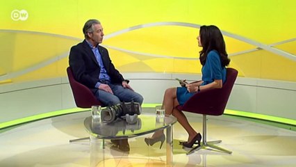 Cómo tratar las fracturas óseas | En forma