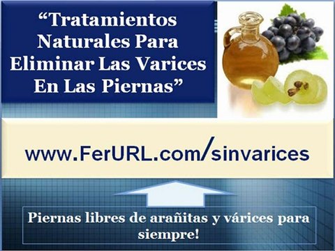 Tratamientos naturales para eliminar las varices en las piernas