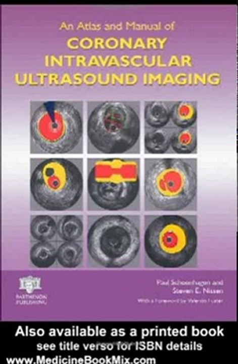 Medicine Book Review: An Atlas and Manual of Coronary Intravascular Ultrasound Imaging by Paul Schoenhagen, Steven E. Nissen