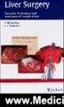 Medicine Book Review: Liver Surgery: Operative Techniques and Avoidance of Complicatons by Koeckerling