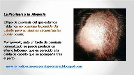 Psoriasis en el cuero cabelludo