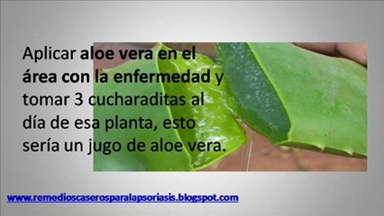 Psoriasis remedios caseros