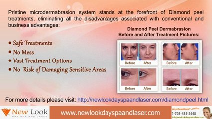Diamond peel Dermabrasion in Newlook Day Spa And Laser