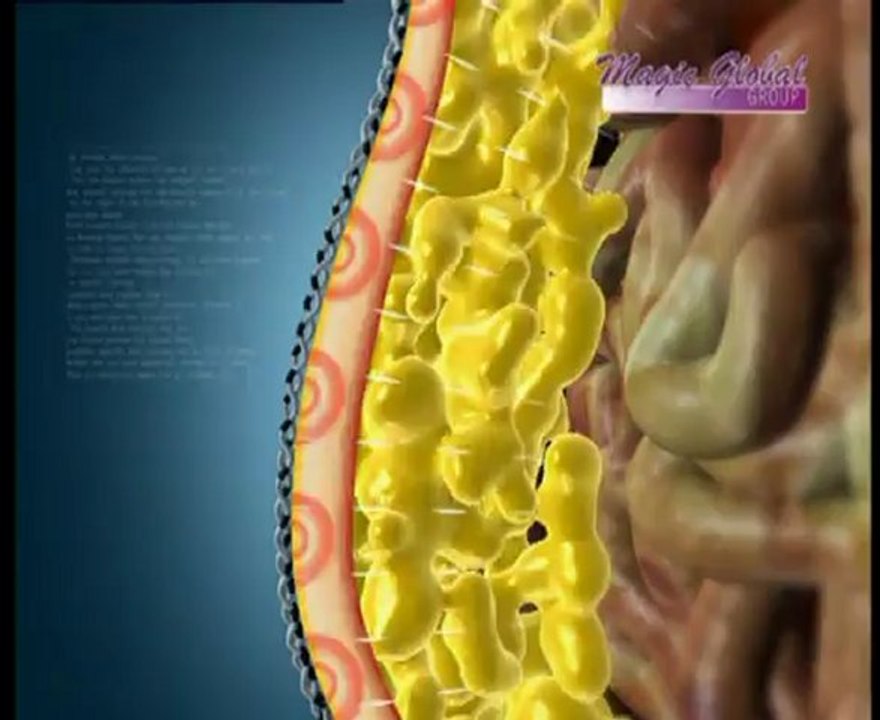 Magic Slim  Body Shaper