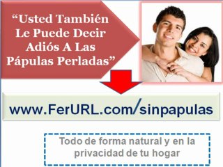 Tratamiento natural para eliminar las papulas perladas