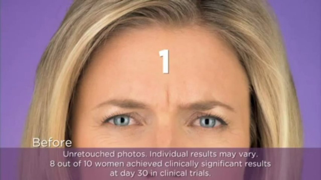 A Quick Guide To Botox Treatment