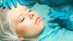 Chin sagging? Firm a sagging chin without surgery: Dr Lycka
