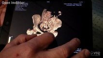 Open Inventor: interactive 3D for web-based applications (medical)