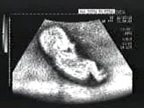 Ecographie de Juan Pablo Montoya