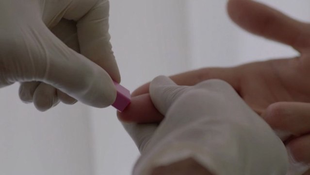 Sida / VIH - Dépistage rapide avec AIDES