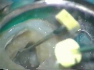 Dr Tarik Ali Farooq- Dental Treatment Root Canal