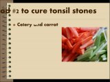 Five Foods to cure tonsil stones naturally