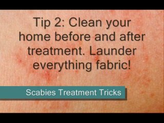 Scabies Treatment Tricks