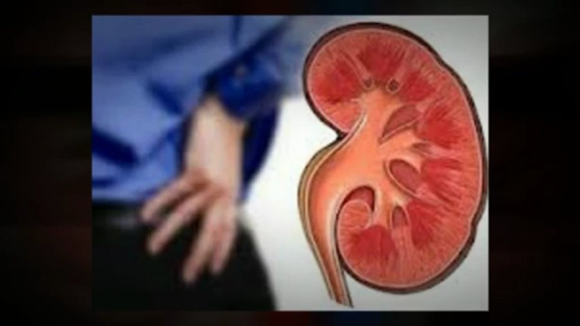 Tratamiento De Insuficiencia Renal - Tratamiento de la Enfermedad Renal