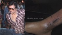Injured In CCL, Sonu Sood Still Promotes Shootout At Wadala - Exclusive
